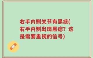 右手内侧关节有黑痣(右手内侧出现黑痣？这是需要重视的信号)