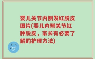 婴儿关节内侧发红脱皮图片(婴儿内侧关节红肿脱皮，家长有必要了解的护理方法)