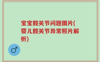 宝宝髋关节问题图片(婴儿髋关节异常照片解析)