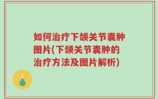 如何治疗下颌关节囊肿图片(下颌关节囊肿的治疗方法及图片解析)