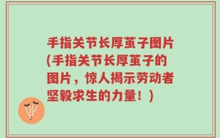 手指关节长厚茧子图片(手指关节长厚茧子的图片，惊人揭示劳动者坚毅求生的力量！)