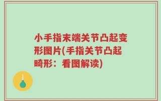 小手指末端关节凸起变形图片(手指关节凸起畸形：看图解读)