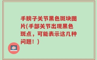 手膀子关节黑色斑块图片(手部关节出现黑色斑点，可能表示这几种问题！)