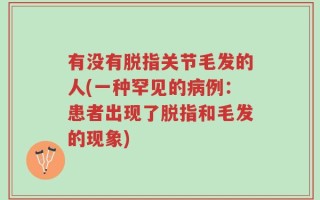 有没有脱指关节毛发的人(一种罕见的病例：患者出现了脱指和毛发的现象)