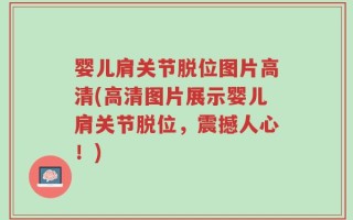 婴儿肩关节脱位图片高清(高清图片展示婴儿肩关节脱位，震撼人心！)