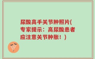 尿酸高手关节肿照片(专家提示：高尿酸患者应注意关节肿胀！)
