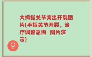 大拇指关节突出开裂图片(手指关节开裂，治疗调整急需  图片演示)