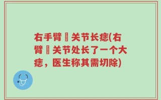 右手臂肑关节长痣(右臂肑关节处长了一个大痣，医生称其需切除)