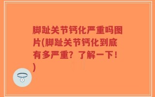 脚趾关节钙化严重吗图片(脚趾关节钙化到底有多严重？了解一下！)