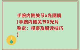 手腕内侧关节x光图解(手腕内侧关节X光片鉴定：观察及解读技巧)