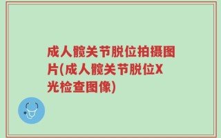 成人髋关节脱位拍摄图片(成人髋关节脱位X光检查图像)