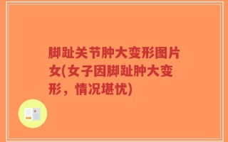 脚趾关节肿大变形图片女(女子因脚趾肿大变形，情况堪忧)