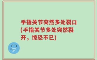 手指关节突然多处裂口(手指关节多处突然裂开，惊恐不已)