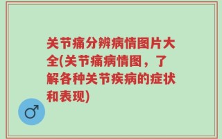 关节痛分辨病情图片大全(关节痛病情图，了解各种关节疾病的症状和表现)