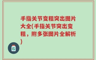 手指关节变粗突出图片大全(手指关节突出变粗，附多张图片全解析)
