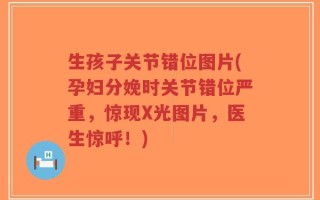 生孩子关节错位图片(孕妇分娩时关节错位严重，惊现X光图片，医生惊呼！)