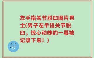 左手指关节脱臼图片男士(男子左手指关节脱臼，惊心动魄的一幕被记录下来！)