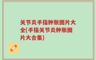 关节炎手指肿胀图片大全(手指关节炎肿胀图片大合集)