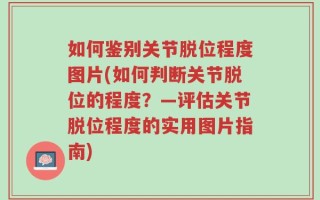 如何鉴别关节脱位程度图片(如何判断关节脱位的程度？—评估关节脱位程度的实用图片指南)