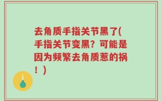 去角质手指关节黑了(手指关节变黑？可能是因为频繁去角质惹的祸！)