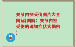 关节内侧受伤图片大全图解(图解：关节内侧受伤的详细症状大揭密)