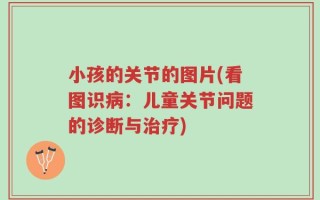 小孩的关节的图片(看图识病：儿童关节问题的诊断与治疗)