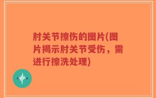 肘关节擦伤的图片(图片揭示肘关节受伤，需进行擦洗处理)