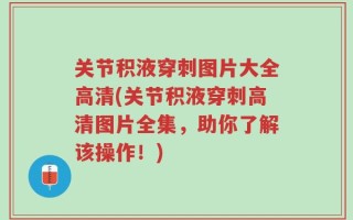 关节积液穿刺图片大全高清(关节积液穿刺高清图片全集，助你了解该操作！)