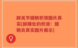 脚关节腱鞘积液图片真实(脚踝处的积液：腱鞘炎真实图片展示)