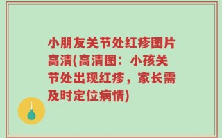 小朋友关节处红疹图片高清(高清图：小孩关节处出现红疹，家长需及时定位病情)