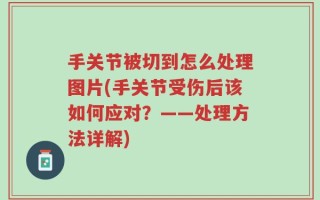 手关节被切到怎么处理图片(手关节受伤后该如何应对？——处理方法详解)