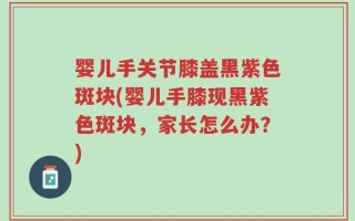 婴儿手关节膝盖黑紫色斑块(婴儿手膝现黑紫色斑块，家长怎么办？)