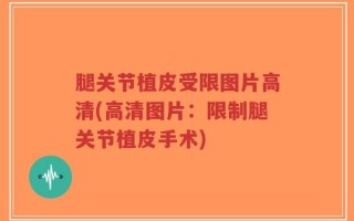 腿关节植皮受限图片高清(高清图片：限制腿关节植皮手术)