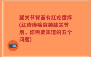 腿关节背面有红疙瘩痒(红疹痒痛突袭膝关节后，你需要知道的五个问题)