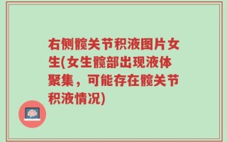 右侧髋关节积液图片女生(女生髋部出现液体聚集，可能存在髋关节积液情况)