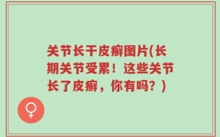 关节长干皮癣图片(长期关节受累！这些关节长了皮癣，你有吗？)