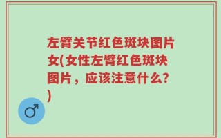 左臂关节红色斑块图片女(女性左臂红色斑块图片，应该注意什么？)