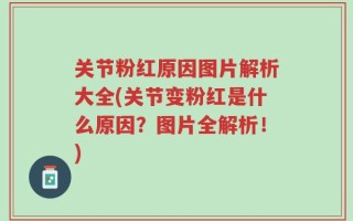 关节粉红原因图片解析大全(关节变粉红是什么原因？图片全解析！)