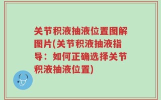关节积液抽液位置图解图片(关节积液抽液指导：如何正确选择关节积液抽液位置)