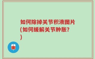 如何除掉关节积液图片(如何缓解关节肿胀？)