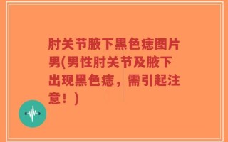 肘关节腋下黑色痣图片男(男性肘关节及腋下出现黑色痣，需引起注意！)