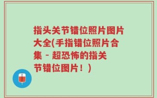 指头关节错位照片图片大全(手指错位照片合集 - 超恐怖的指关节错位图片！)