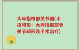 大母指根部关节图(手指畸形：大拇指根部骨关节畸形及手术治疗)