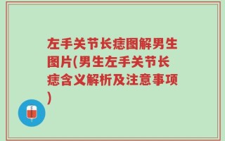 左手关节长痣图解男生图片(男生左手关节长痣含义解析及注意事项)