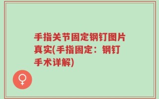 手指关节固定钢钉图片真实(手指固定：钢钉手术详解)