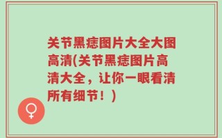 关节黑痣图片大全大图高清(关节黑痣图片高清大全，让你一眼看清所有细节！)