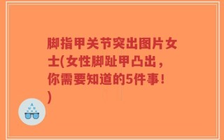脚指甲关节突出图片女士(女性脚趾甲凸出，你需要知道的5件事！)