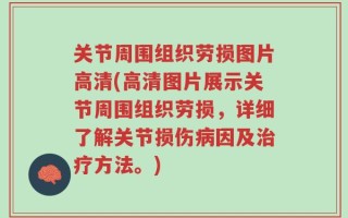 关节周围组织劳损图片高清(高清图片展示关节周围组织劳损，详细了解关节损伤病因及治疗方法。)
