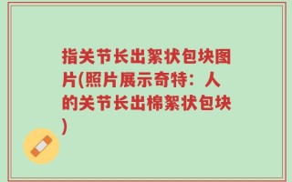 指关节长出絮状包块图片(照片展示奇特：人的关节长出棉絮状包块)