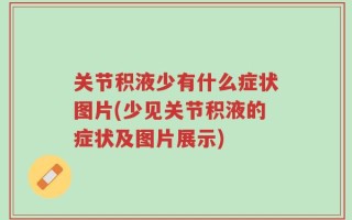 关节积液少有什么症状图片(少见关节积液的症状及图片展示)